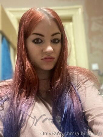 Albinoteen