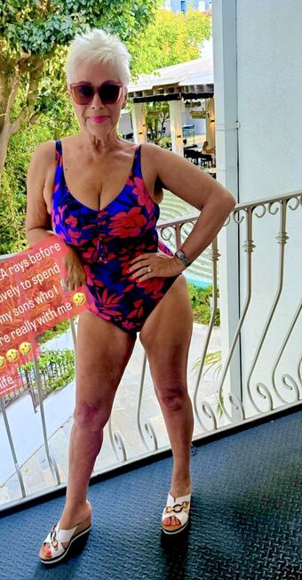 Denise Welch